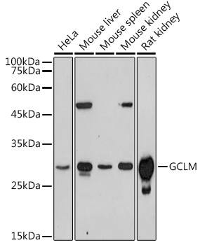 GCLM Antibody