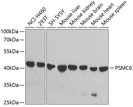 PSMC6 Antibody