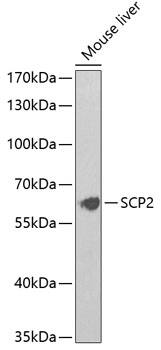 Sterol carrier protein 2 Antibody