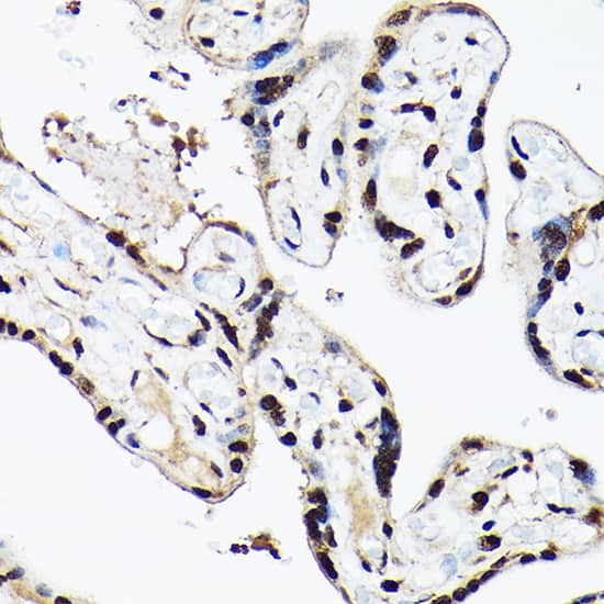 BAF53A Antibody