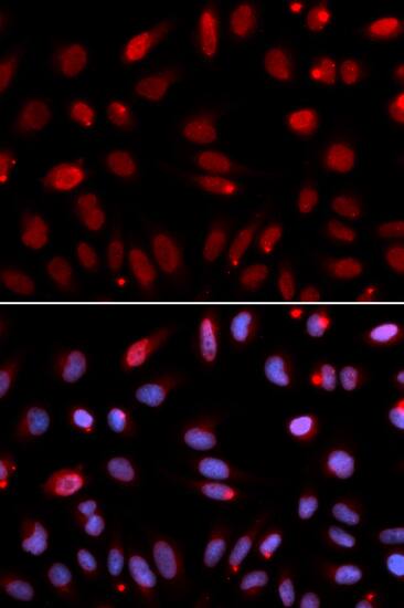 HUS1 Antibody