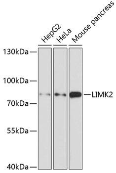 LIM kinase 2 Antibody