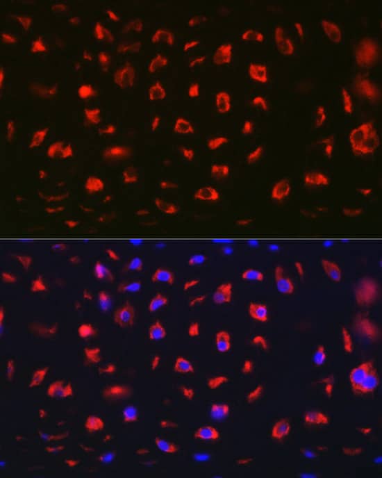 MGP Antibody