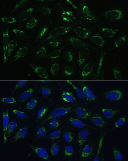 ERAB Antibody