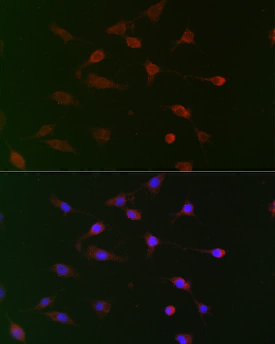 UBE2R1/CDC34 Antibody