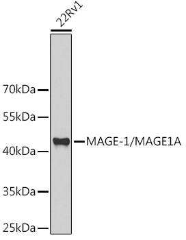 MAGEA1 Antibody