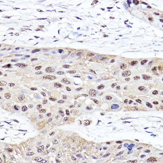 Proteasome 20S beta2 Antibody