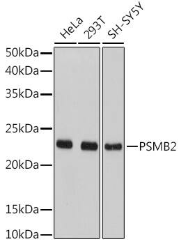 Proteasome 20S beta2 Antibody