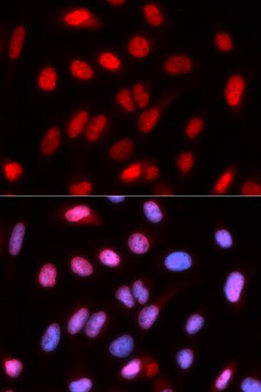 RFC4 Antibody