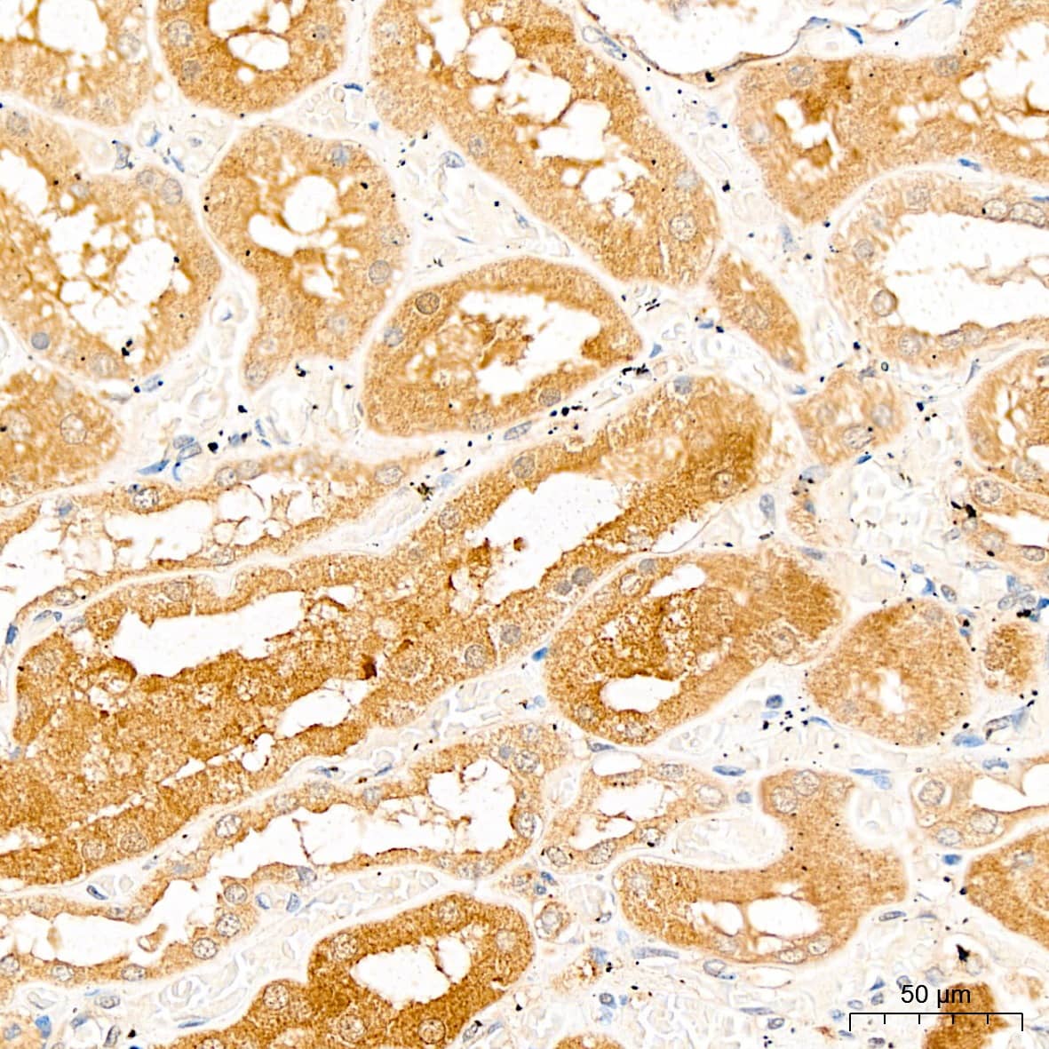 PSMF1 Antibody