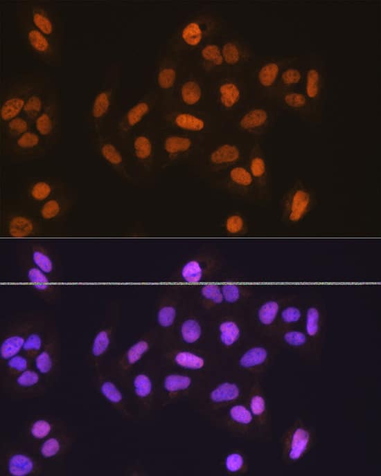 MCM5 Antibody