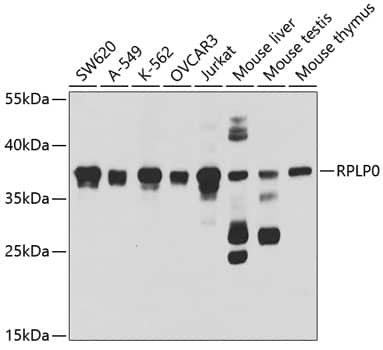 RPLP0 Antibody