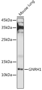 GnRH Antibody