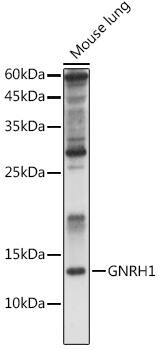 GnRH Antibody