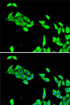 Cdk5 Antibody
