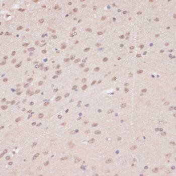 PRPF31 Antibody