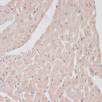 PRPF31 Antibody