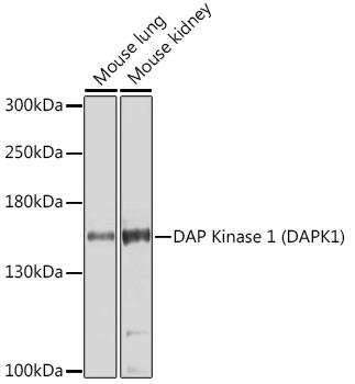 DAP Kinase 1 Antibody