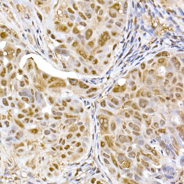 Proteasome 20S alpha 5 Antibody