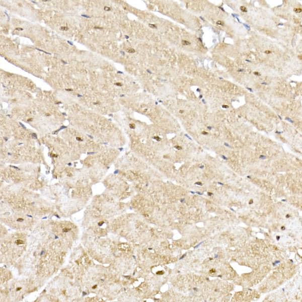 Proteasome 20S alpha 5 Antibody