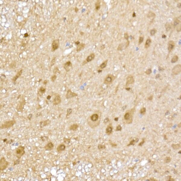 Proteasome 20S alpha 5 Antibody