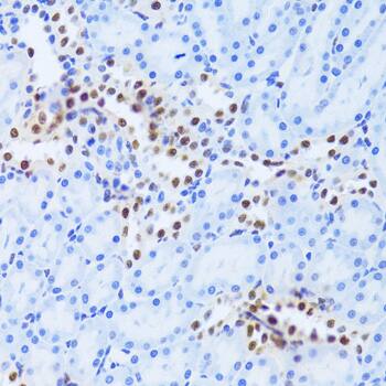 ANP32A Antibody