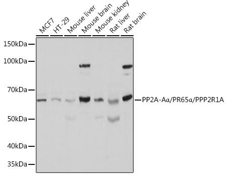 PPP2R1A Antibody