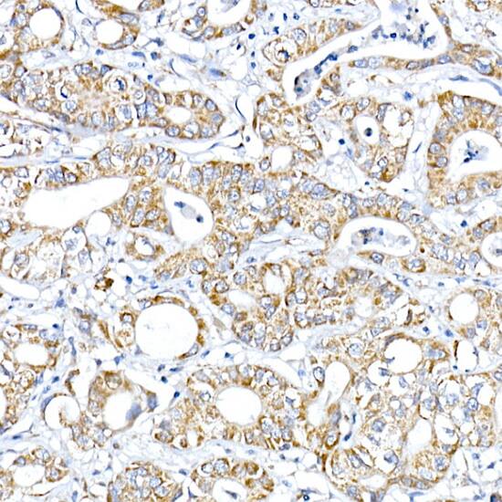 PTPIP51 Antibody