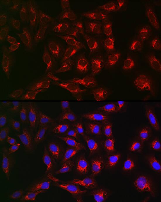 PTPIP51 Antibody