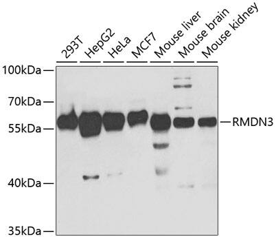PTPIP51 Antibody