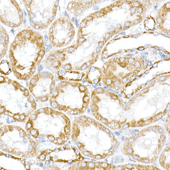 PTPIP51 Antibody