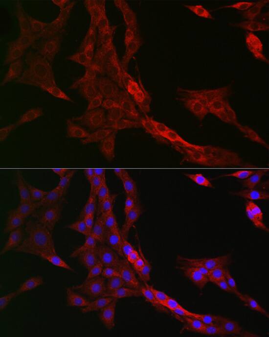 PTPIP51 Antibody