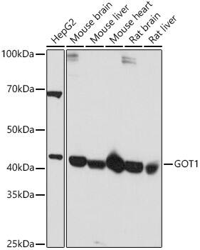 Aspartate Aminotransferase Antibody