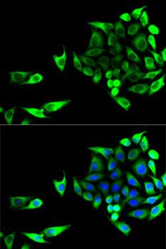Aspartate Aminotransferase Antibody