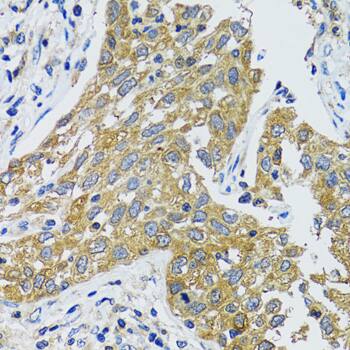 Aspartate Aminotransferase Antibody