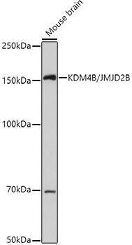 JMJD2B Antibody