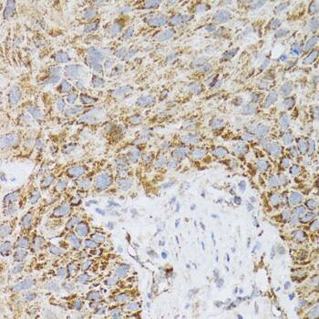 Prodynorphin/PDYN Antibody