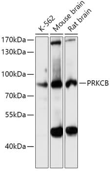 PKC beta Antibody