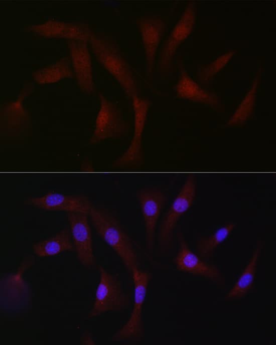 PKC beta Antibody