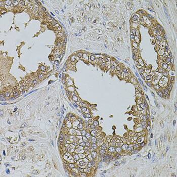 kinectin Antibody