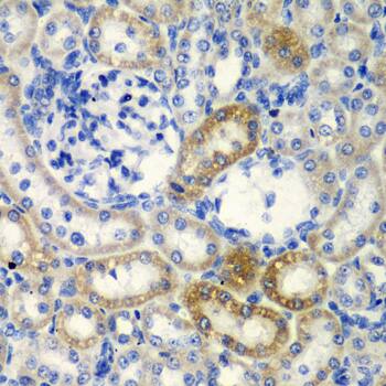 Deoxycytidylate deaminase Antibody