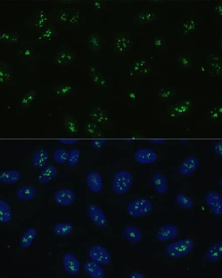 NOLC1 Antibody