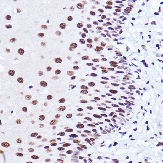 Matrin 3 Antibody