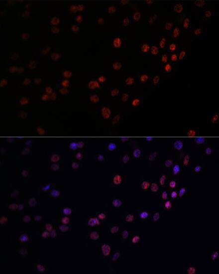 Matrin 3 Antibody