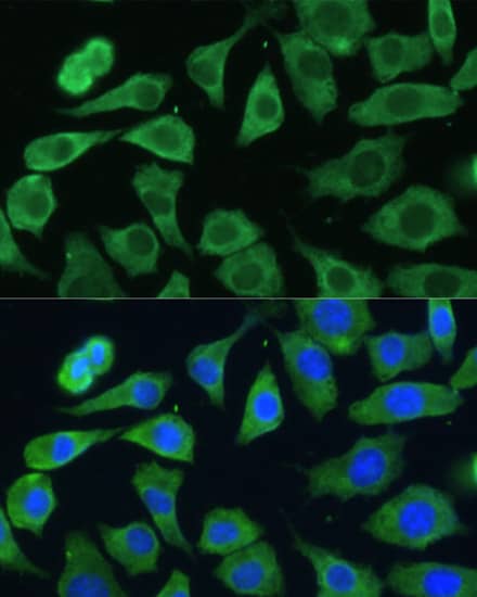 EIF3D Antibody