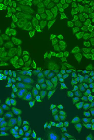 PABPC4 Antibody