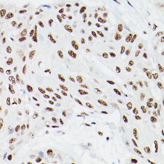 CPSF6 Antibody