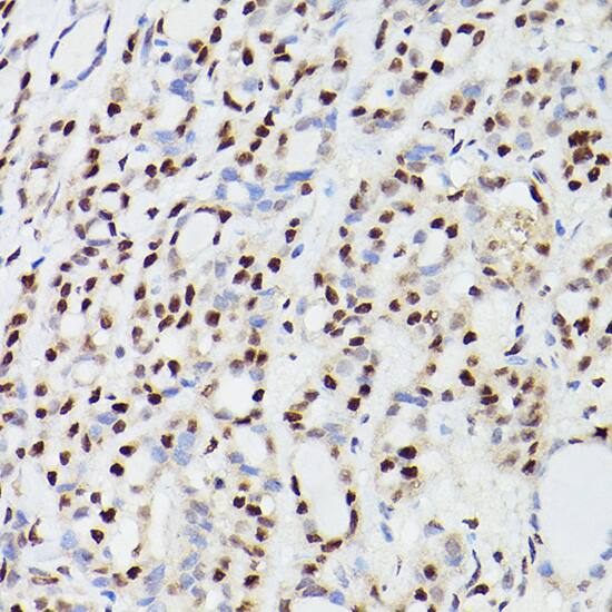 CPSF6 Antibody