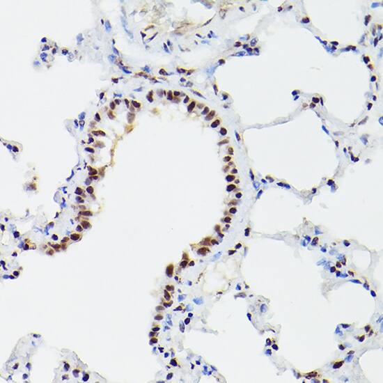 CPSF6 Antibody