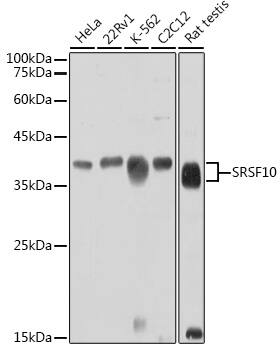 FUSIP1 Antibody